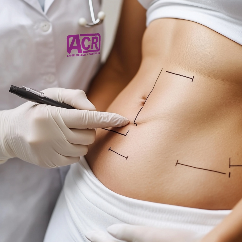 Demostración de HIFU Liposonix corporal en un curso especializado